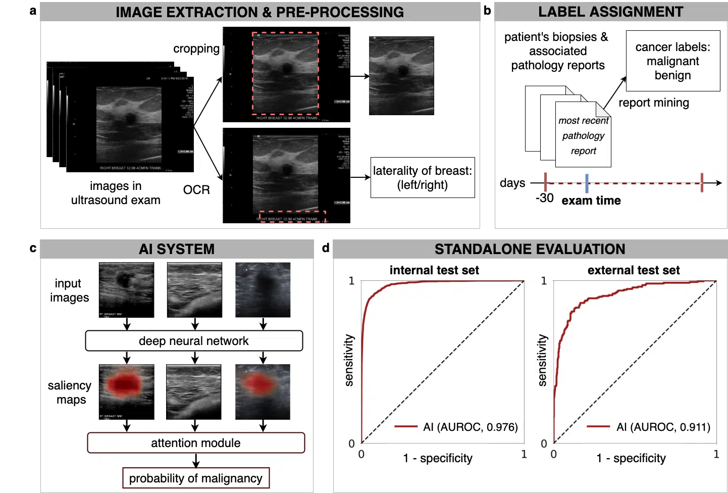 AI in Breast Cancer Detection