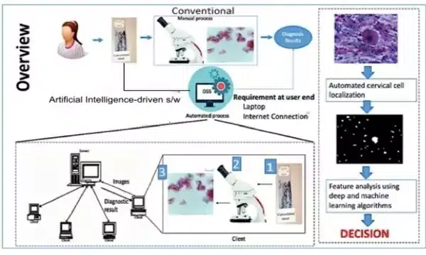 AI in Cervical Cancer Detection